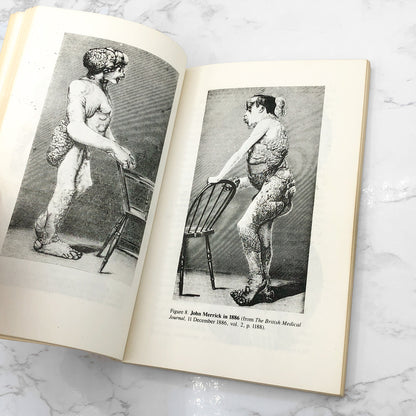 The Elephant Man: A Study in Human Dignity by Ashley Montagu [SECOND EDITION] 1979 • Dutton